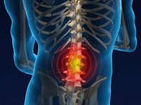 Evidence based care for lower back pain in primary setting 
